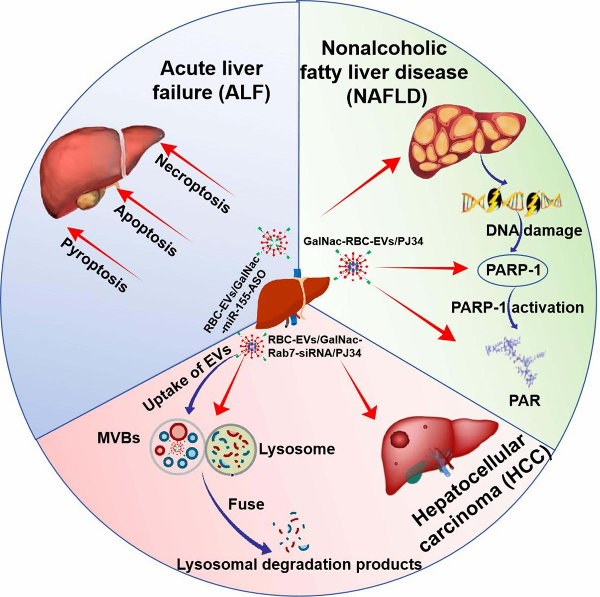Protective Effects of GalNac-Modified Red Blood Cell-Derived Extracellular Vesicles Against Liver  Diseases