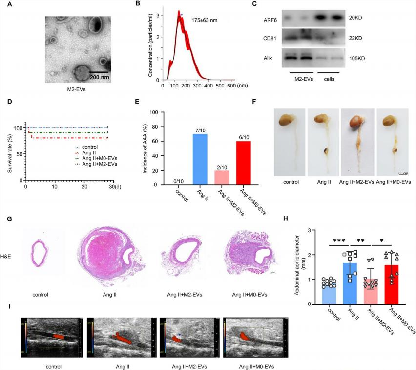 M2 macrophage-derived extracellular vesicles protect against abdominal aortic aneurysm by modulating macrophage     polarization through miR221-5p